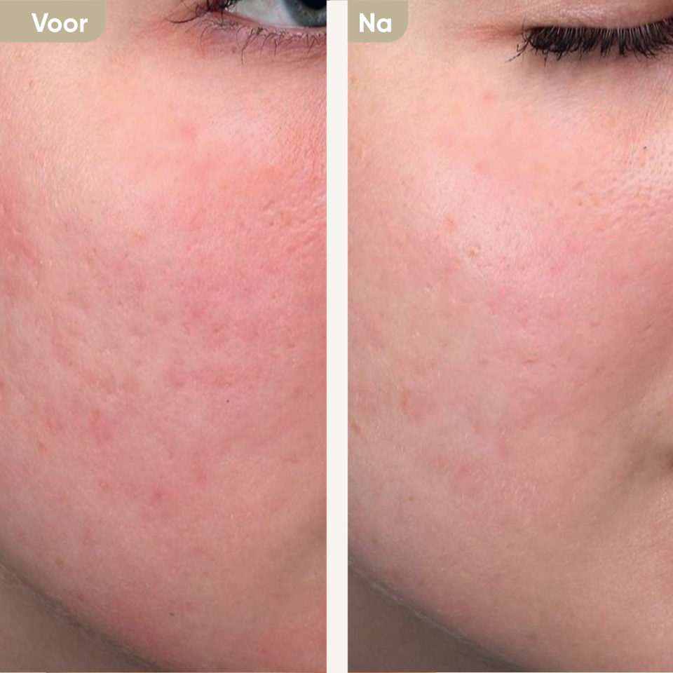 PolyPhil | skinbooster
